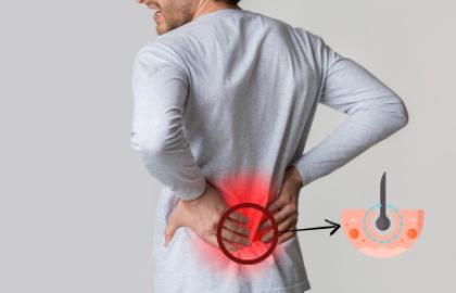 Pilonidal Sinus : Causes, Symptoms and Treatment